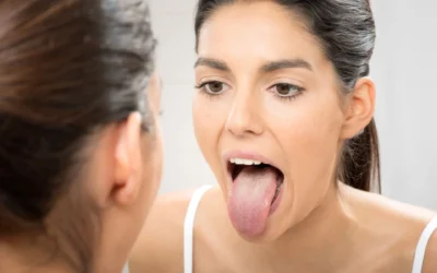 Diagnostika jazyka v tradičnej čínskej medicíne.