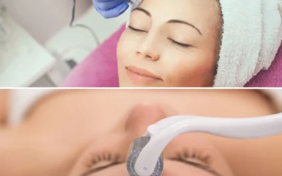 Mezoterapia alebo microneedling?